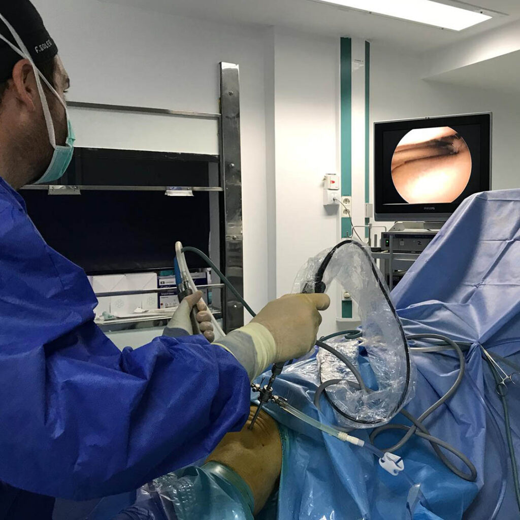 Dr. Soler Traumatólogo Artroscopia Dr. Soler Traumatólogo Artroscopia