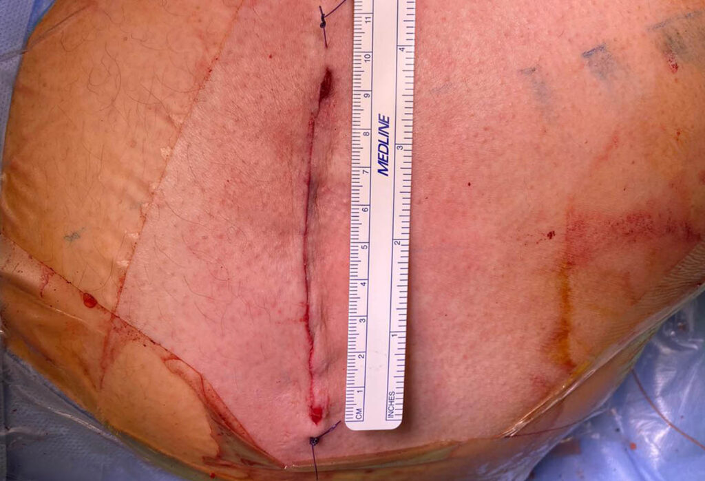 Dr. Soler Traumatólogo Pionero en Cirugía de Cadera Dr. Soler Traumatólogo Pionero en Cirugía de Cadera