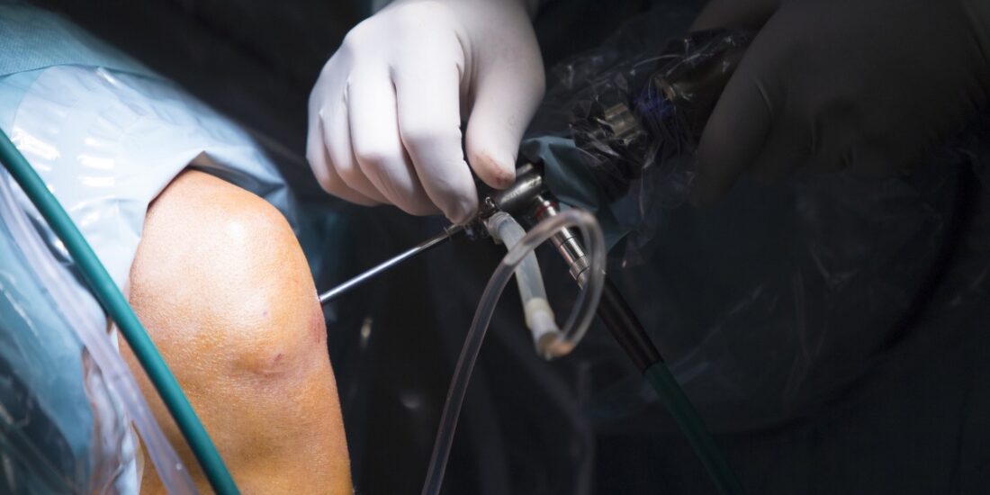 Que es artroscopia de rodilla